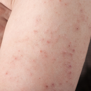 skin irritations on arms