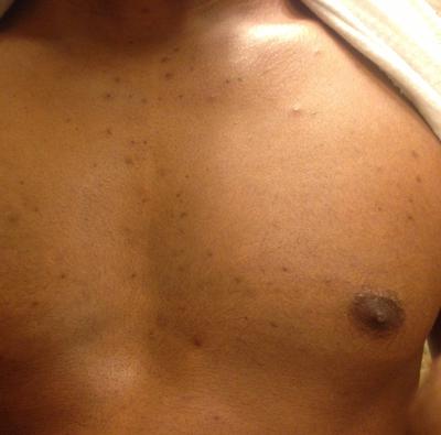 dark rash on skin #10