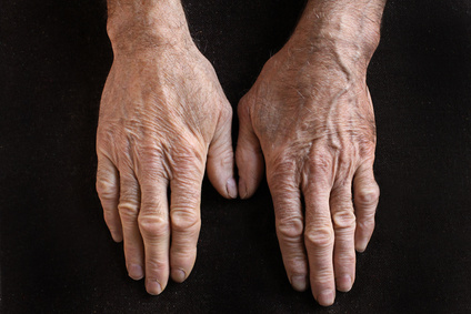 Aging hands with wrinkles on skin.