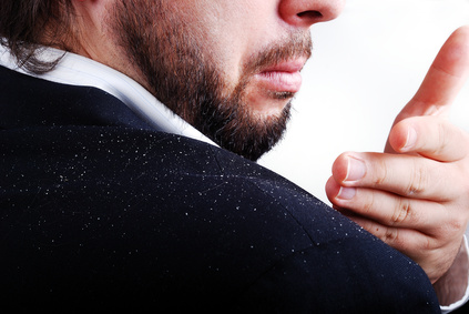 man with dandruff flakes on his shoulder looking for a dandruff cure