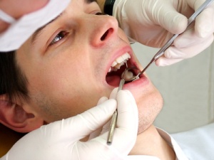 dental resources and man with open mouth at the dentist