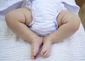 A diaper on a baby can cause a diaper rash.