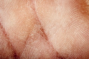 dry flaky skin on hand