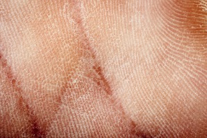 dry flaky skin on hand