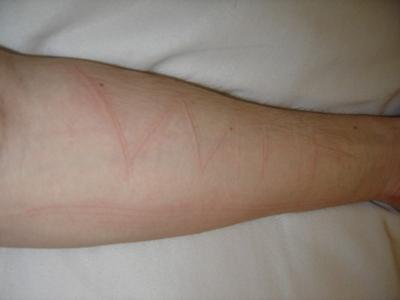Skin Writing on Arm