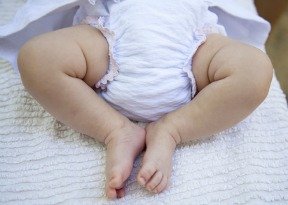 A diaper on a baby can cause a diaper rash.