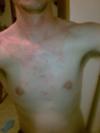 Undiagnosed Non Itchy Skin Rash on Chest