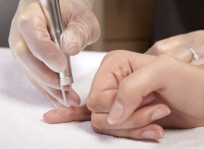 wart removal treatment on finger